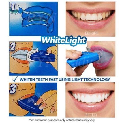 White Light Teeth Whitening Brightener | No box card packing  and cell operated.